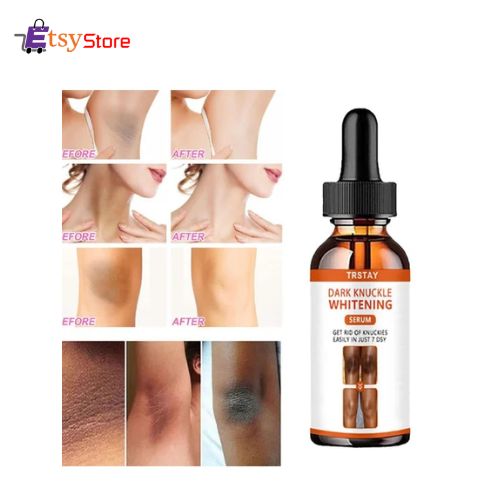 TRSTAY Dark Knuckle Whitening Serum In Pakistan