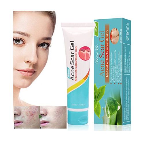 Acne Scar Gel in Pakistan